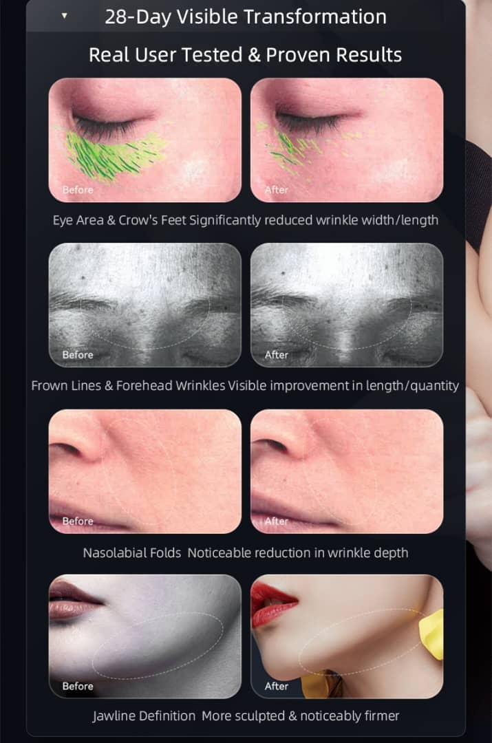 BRÜUN 6-in-1 Microcurrent Facial Device – Professional Skin Tightening & Anti-Aging Tool for Face, Eyes, and Neck Bruun Beauty 