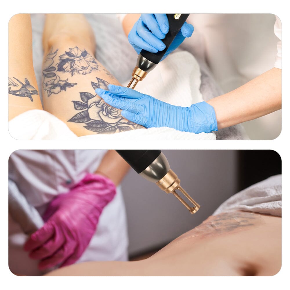 BRÜUN 3-in-1 Picosecond Laser Machine with Laser Head for Tattoo Removal & Carbon Facial Peel
